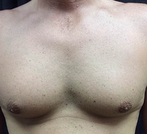 chest4-before