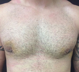 chest8-after