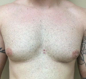 chest8-before
