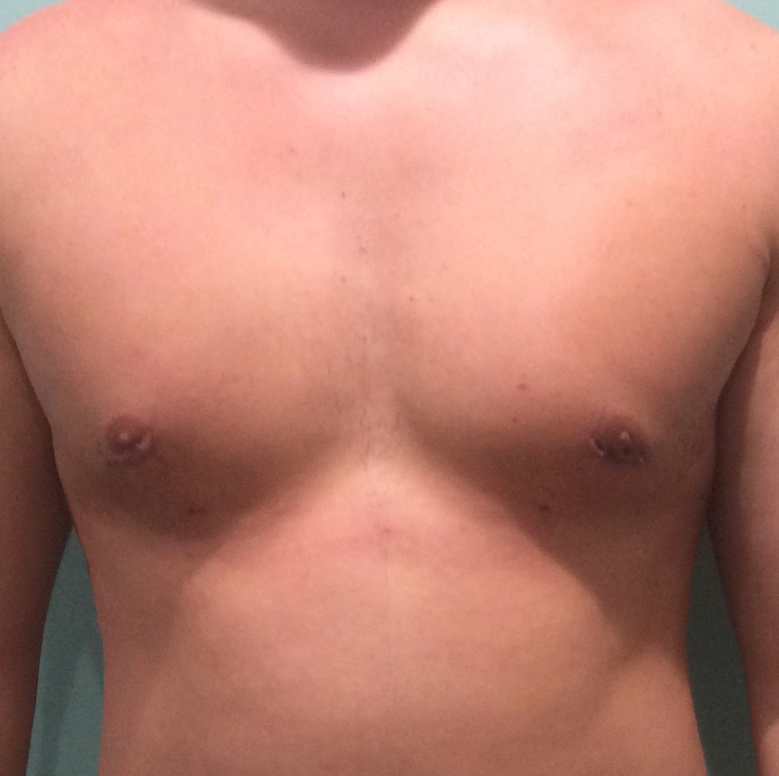 man-chest-after